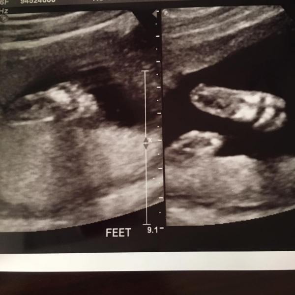 13254533_10208411869507978_1361467173572731856_n